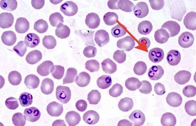 Пироплазмы в красных кровяных клетках под микроскопом